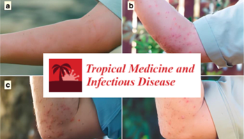 The Human Health Impacts of the Red Imported Fire Ant in the Western Pacific Region Context: A Narrative Review